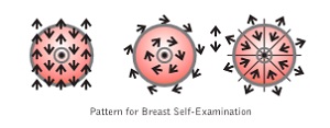 Breast Cancer 05