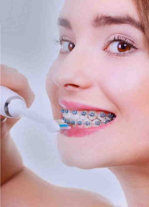 Importance of Clean Teeth 01