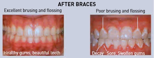 Importance of Clean Teeth 05