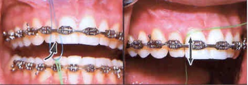 Importance of Clean Teeth 06