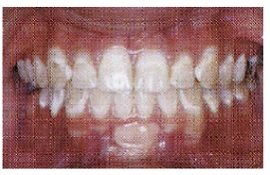 Importance of Clean Teeth 08