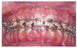Importance of Clean Teeth 09