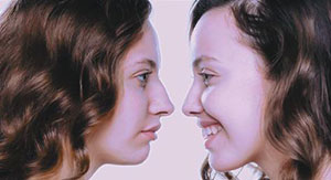 Nose Reshaping Female