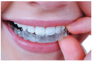 Teeth Grinding 06