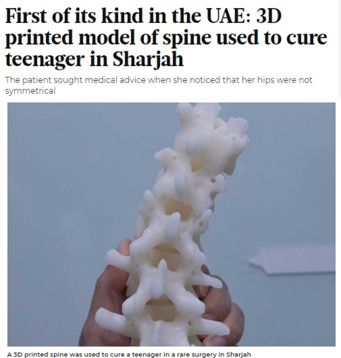 patient-specific 3D-printed Spine Model