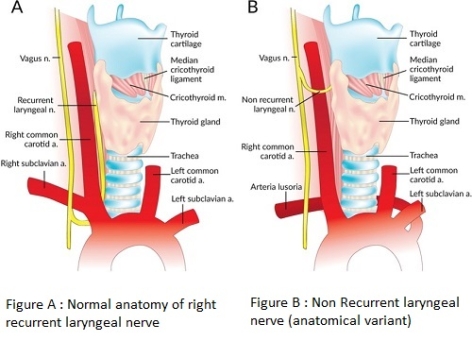 CASE OF THE WEEK – “A rare case report of Non-recurrent laryngeal nerve in a patient who underwent total thyroidectomy” Dr Shwan Mohamad  Consultant ENT Surgeon & Dr Nawal Ibrahim, Consultant Endocrinology & Internal Medicine, NMC Royal Hospital Sharjah
